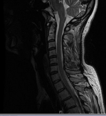 mrt-SAG-T2-FSE.JPG